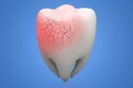 Broken human Tooth on blue background. 3d illustration Royalty Free Stock Photo