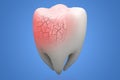 Broken human Tooth on blue background. 3d illustration