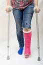 Broken Leg and Crutches Royalty Free Stock Photo