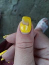 Broken Nail Of Women