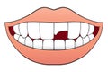 Broken Tooth