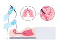Bronchoscopy procedure concept