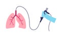 Bronchoscopy procedure concept Royalty Free Stock Photo