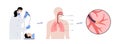 Bronchoscopy procedure concept