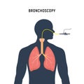 Bronchoscopy respiratory system emphysema endoscopy human lung examination. Bronchoscopy icon Royalty Free Stock Photo