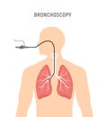 Bronchoscopy respiratory system emphysema endoscopy human lung examination. Bronchoscopy icon Royalty Free Stock Photo