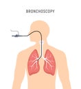 Bronchoscopy respiratory system emphysema endoscopy human lung examination. Bronchoscopy icon