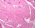 Brown adipose tissue