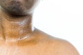 Brown skin sweating neck and chest Royalty Free Stock Photo