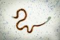 Brugia malayi, a roundworm nematode Royalty Free Stock Photo