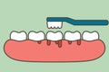 Brushing teeth with bleeding on gum and tooth, gingivitis or scurvy concept