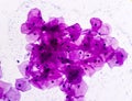 Buccal smear showing desquamated squamous cells