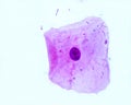 Squamous epithelial cell Royalty Free Stock Photo