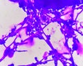 Budding yeast cells with pseudohyphae