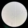 Budding yeast cells with pseudohyphae in urine sample