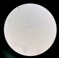 Budding yeast cells with pseudohyphae in urine sample