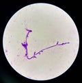 Budding yeast cells with pseudohyphae in urine sample on wright gimsa stain