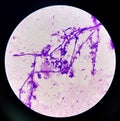 Budding yeast cells with pseudohyphae in urine sample on wright gimsa stain