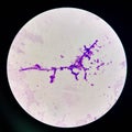 Budding yeast cells with pseudohyphae in urine sample on wright gimsa stain