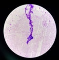 Budding yeast cells with pseudohyphae in urine sample on wright gimsa stain