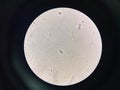 Budding yeast with pseudo hephae in urine Royalty Free Stock Photo
