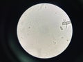 Budding yeast with pseudo hephae in urine Royalty Free Stock Photo