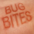 Bug Bites