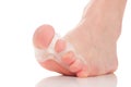 Bunion, hallux valgus. Separator Royalty Free Stock Photo