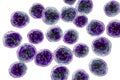 Burkitt`s lymphoma cells, is a cancer of the lymphatic system Royalty Free Stock Photo