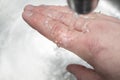 Burned skin on a finger. Caucasian man keeps hand under the cold runing water