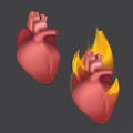 Burning anatomical heart. Realistic human organ of internal blood circulation system in flame. Vector illustration Royalty Free Stock Photo