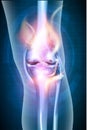 Burning leg knee joint Royalty Free Stock Photo