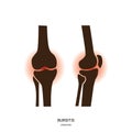 Bursitis and Knee Joint Icon