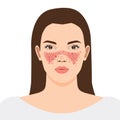Butterfly autoimmune symptoms of SLE on the nose and cheeks of woman, illustration on white background