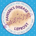 Button with Sick Skin Promoting Prevention during World Leprosy Day, Vector Illustration