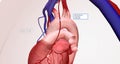 During CABG surgery, grafts from the saphenous vein or internal thoracic artery are attached to the coronary artery below the area