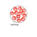 Cabot rings. Anemia of the blood. Red cells are erythrocytes in the blood. Vector illustration on isolated background Royalty Free Stock Photo