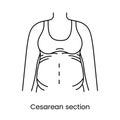 Caesarean section views icon line in vector, illustration of a pregnant woman.