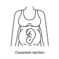 Caesarean section views icon line in vector, illustration of a pregnant woman.