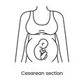 Caesarean section views icon line in vector, illustration of a pregnant woman.