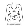 Caesarean section views icon line in vector, illustration of a pregnant woman.