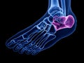 The calcaneus bone Royalty Free Stock Photo