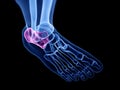 The calcaneus bone Royalty Free Stock Photo
