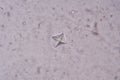 Calcium oxalate crystal