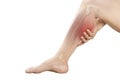 Calf muscle pain Royalty Free Stock Photo