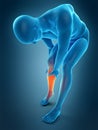 Calf pain