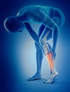 Calf pain Royalty Free Stock Photo