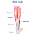 Calf pain. Calf muscle anatomy