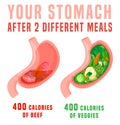 Calorie density poster. What 400 calories look like in the stomach.