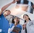 Can you see the difference. a group of doctors discussing the results of an X-ray in a hospital. Royalty Free Stock Photo